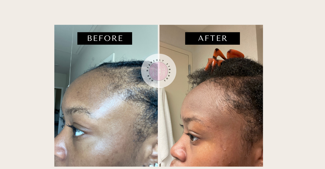 Before and after comparison of a person's scalp with hair growth.